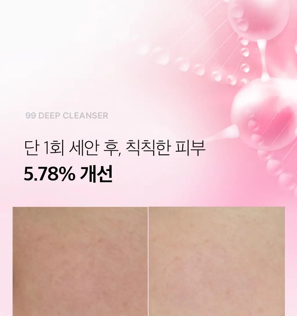 [피지뽑는] 에이프릴스킨 트라넥삼산 딥클렌저 120g 기획 (+15g 미니어처) 상세페이지 16
